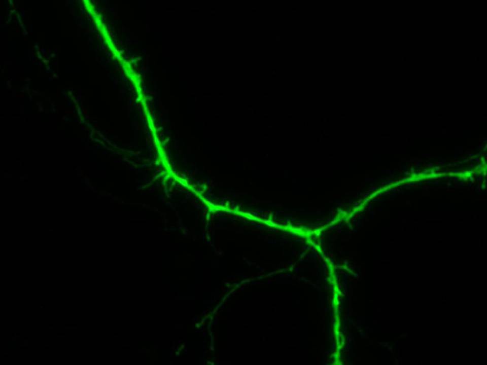 Primary Mouse Neurons in Adherence